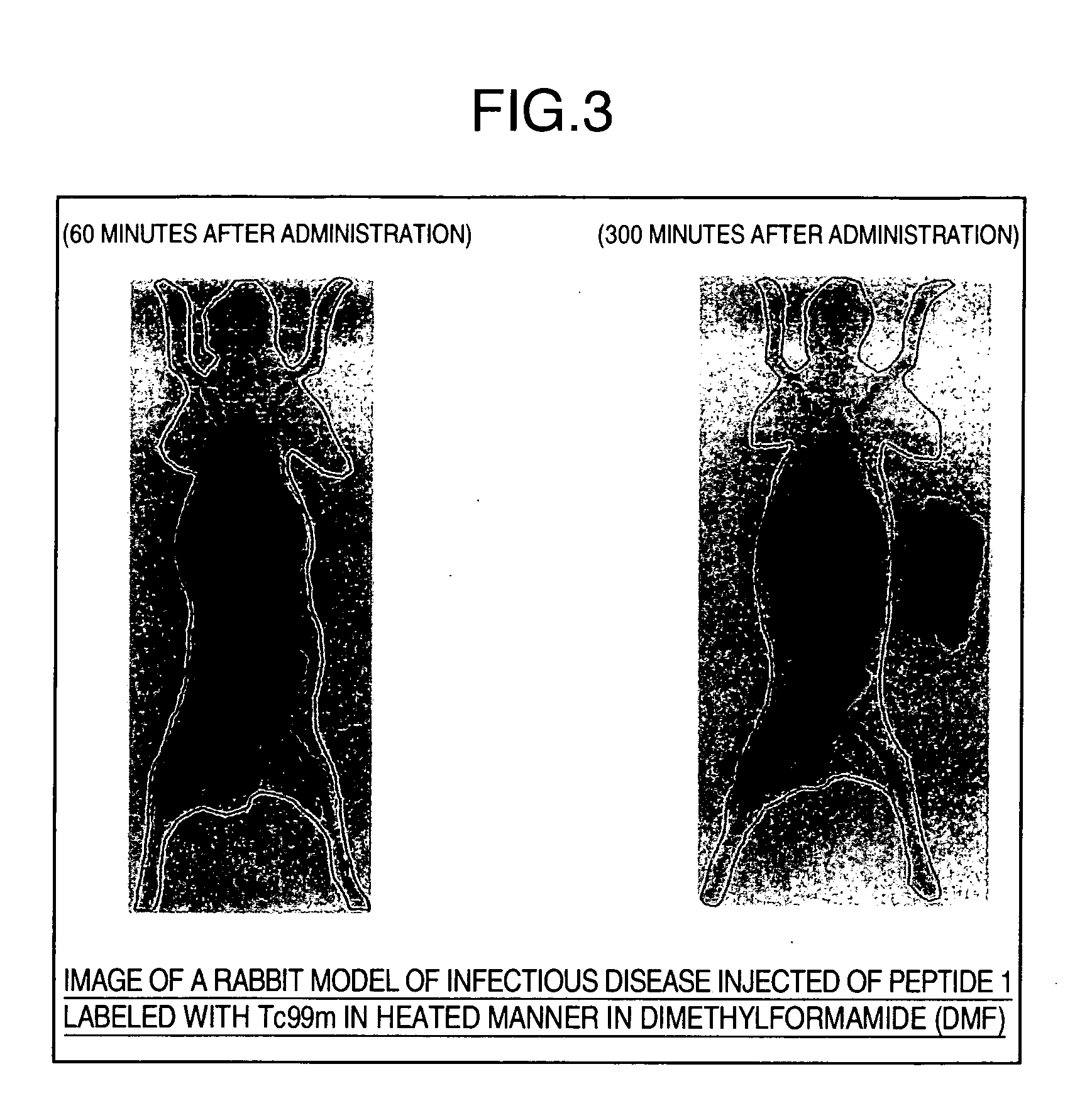 Composition for medical use having improved water-solubility of peptide and metal-labeling efficiency and preparation for medical use comprising metal-labeled peptide