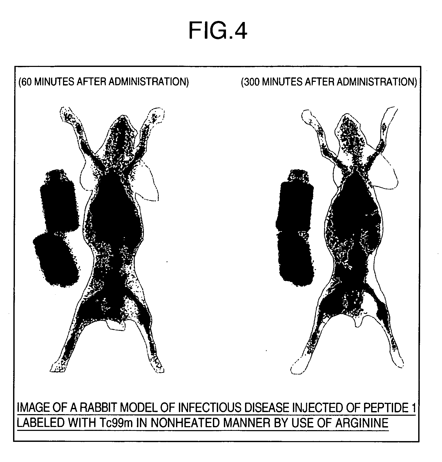 Composition for medical use having improved water-solubility of peptide and metal-labeling efficiency and preparation for medical use comprising metal-labeled peptide