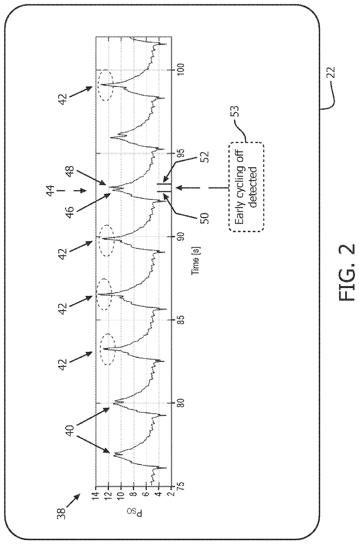 Anomaly detection device and method for respiratory mechanics parameter estimation