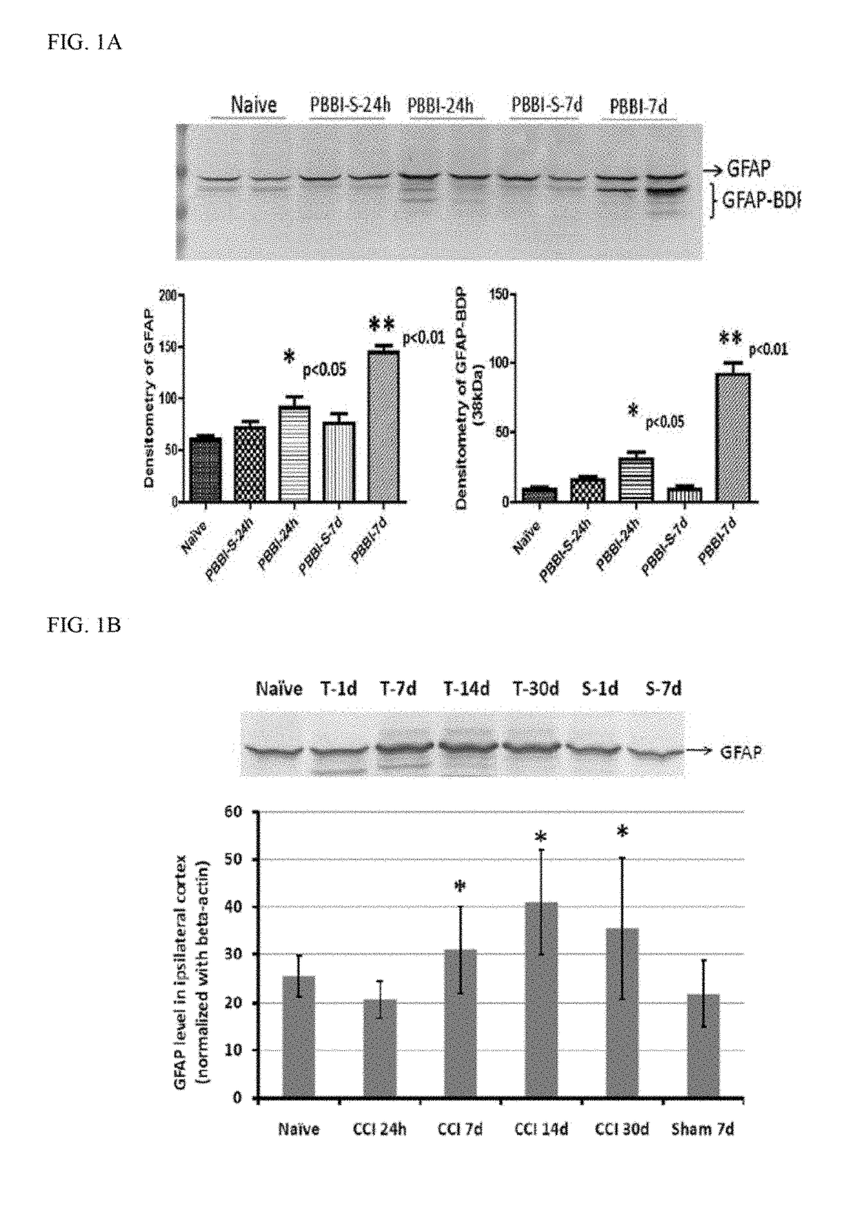 Micro-rna, autoantibody and protein markers for diagnosis of neuronal injury