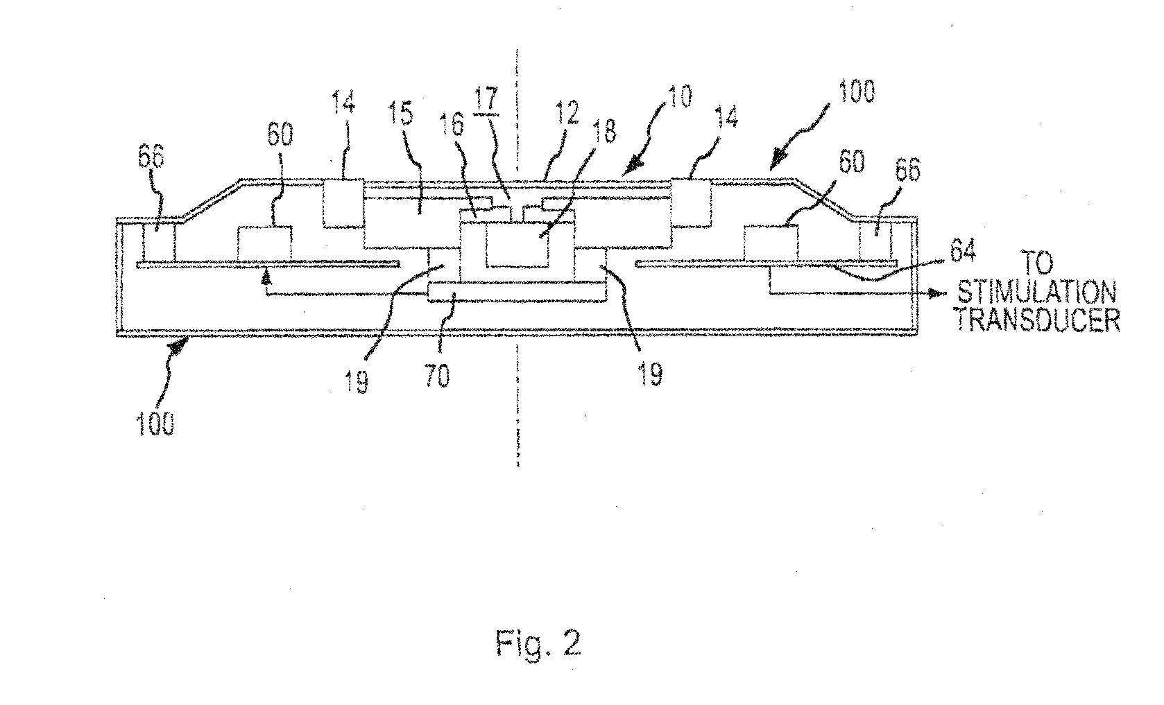 Adaptive Cancellation System For Implantable Hearing Instruments