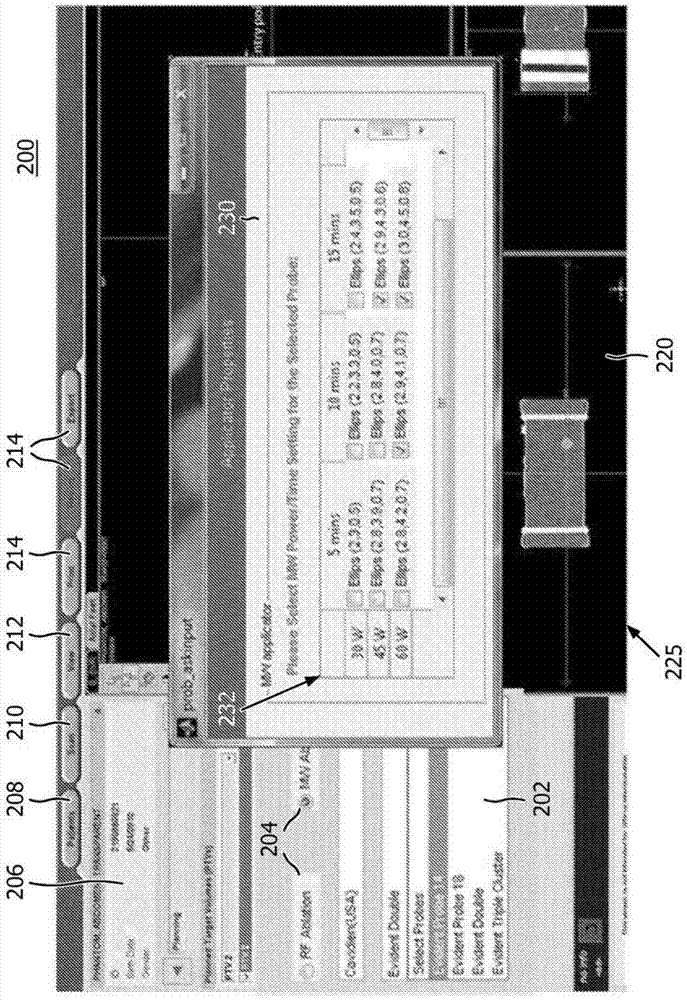 Ablation Planning System