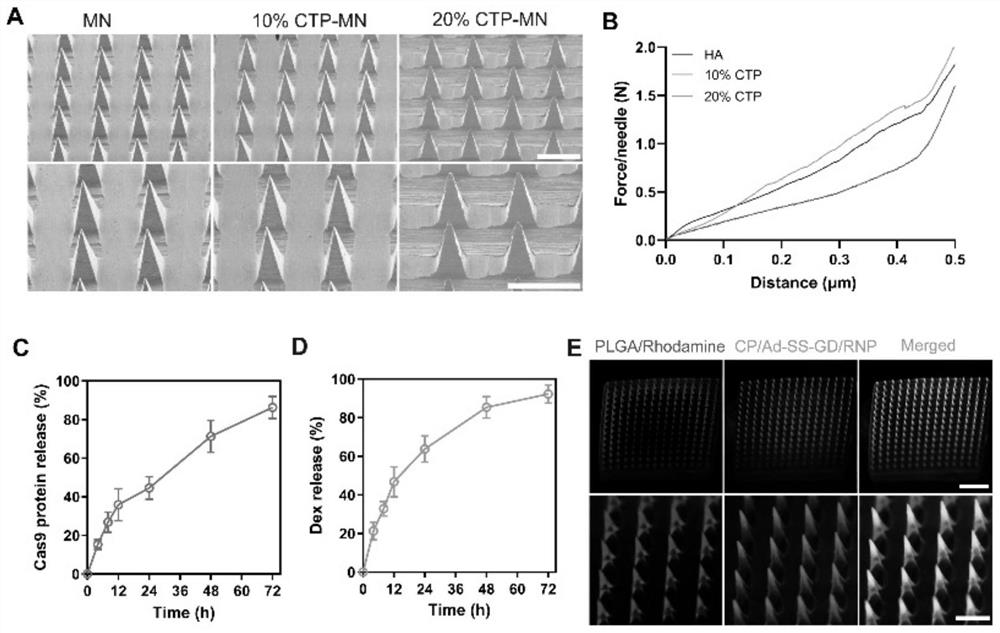 A gene-edited microneedle for the treatment of inflammatory skin diseases and its application