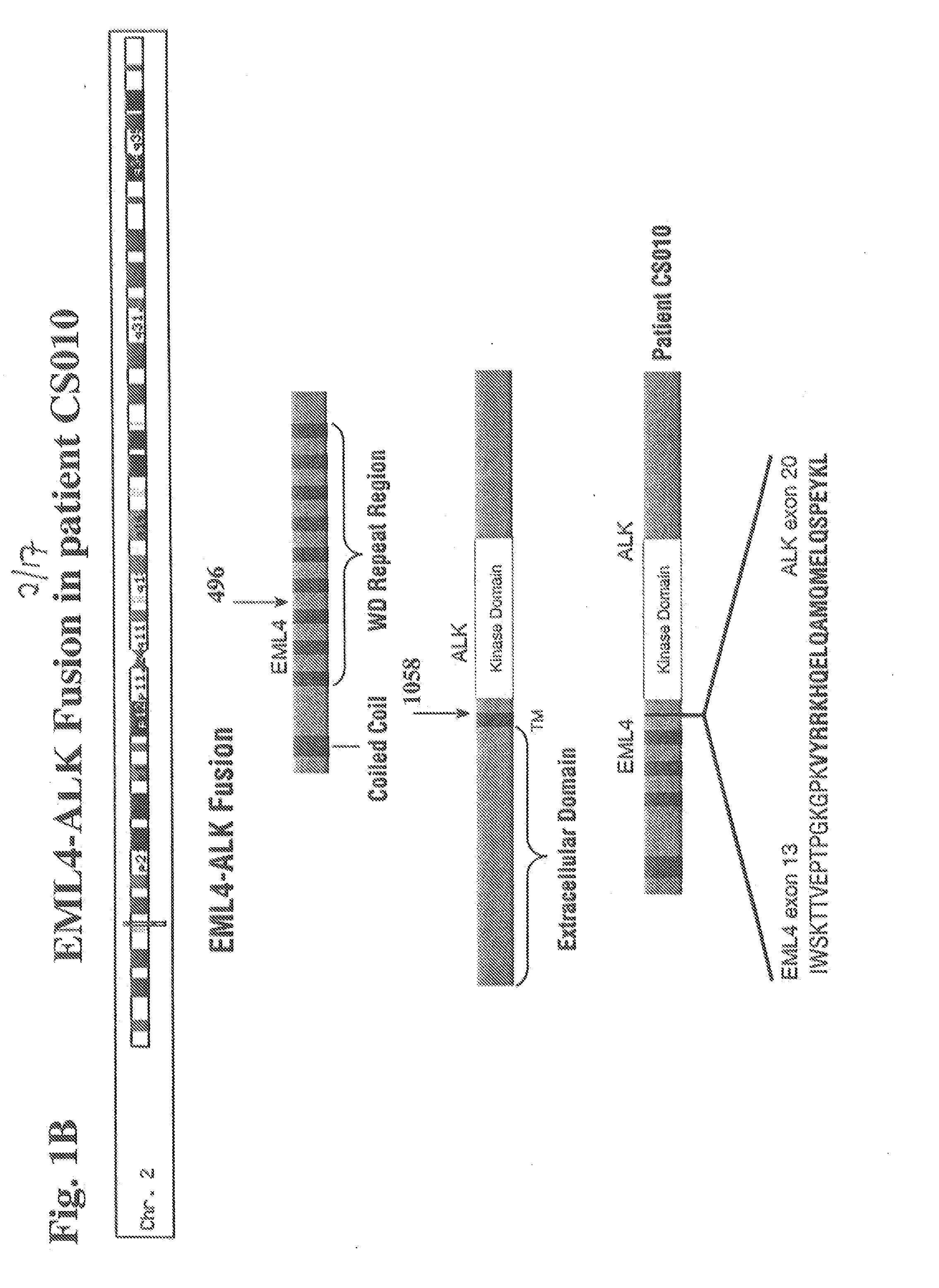 Gene Defects And Mutant ALK Kinase In Human Solid Tumors