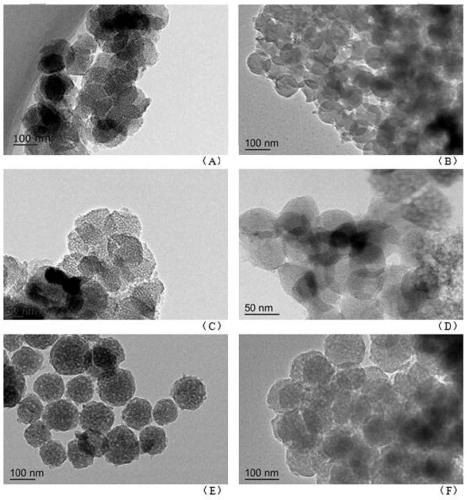 Insulin mesoporous carbon particles and its preparation method, oral preparation and application
