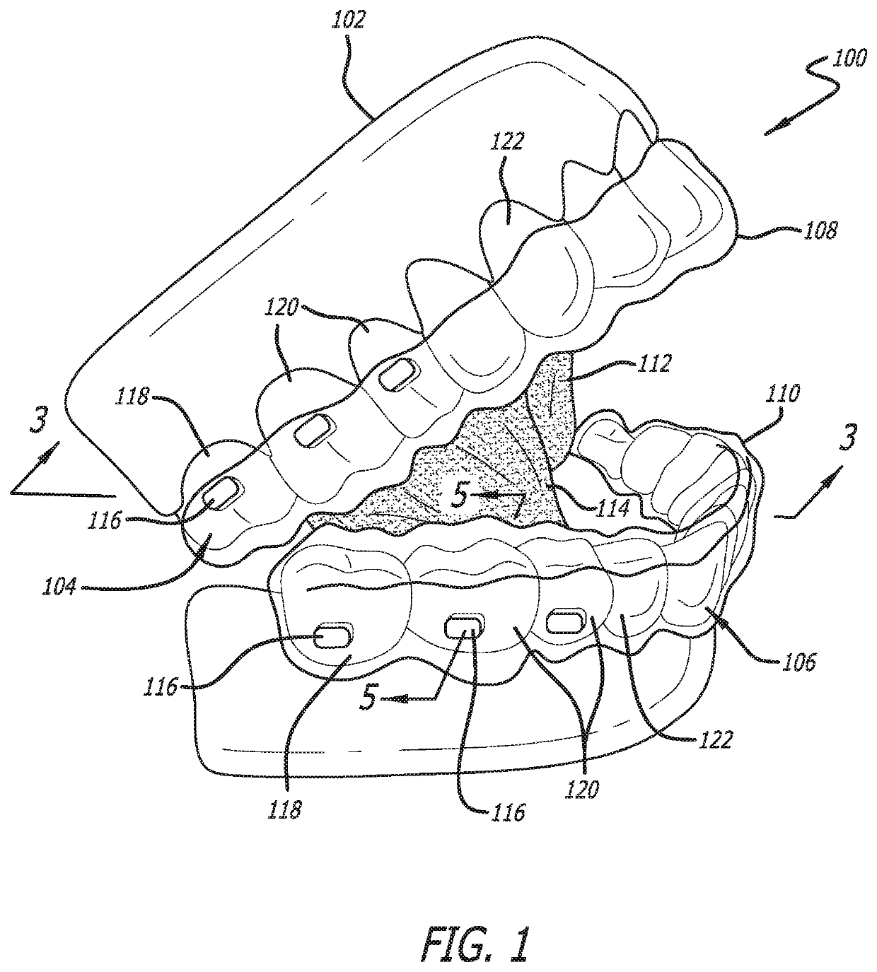 Oral weight control device