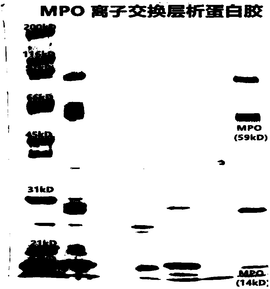 Method for preparing natural myeloperoxidase from neutrophil azurophilic granules of human blood