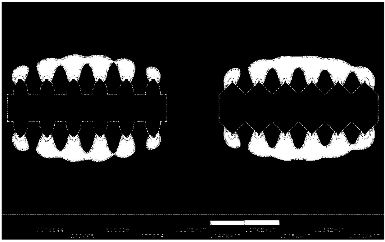 Single-surface tooth plate medium, double-surface tooth plate medium, tooth plate medium box and flat ring high-intensity magnetic separator