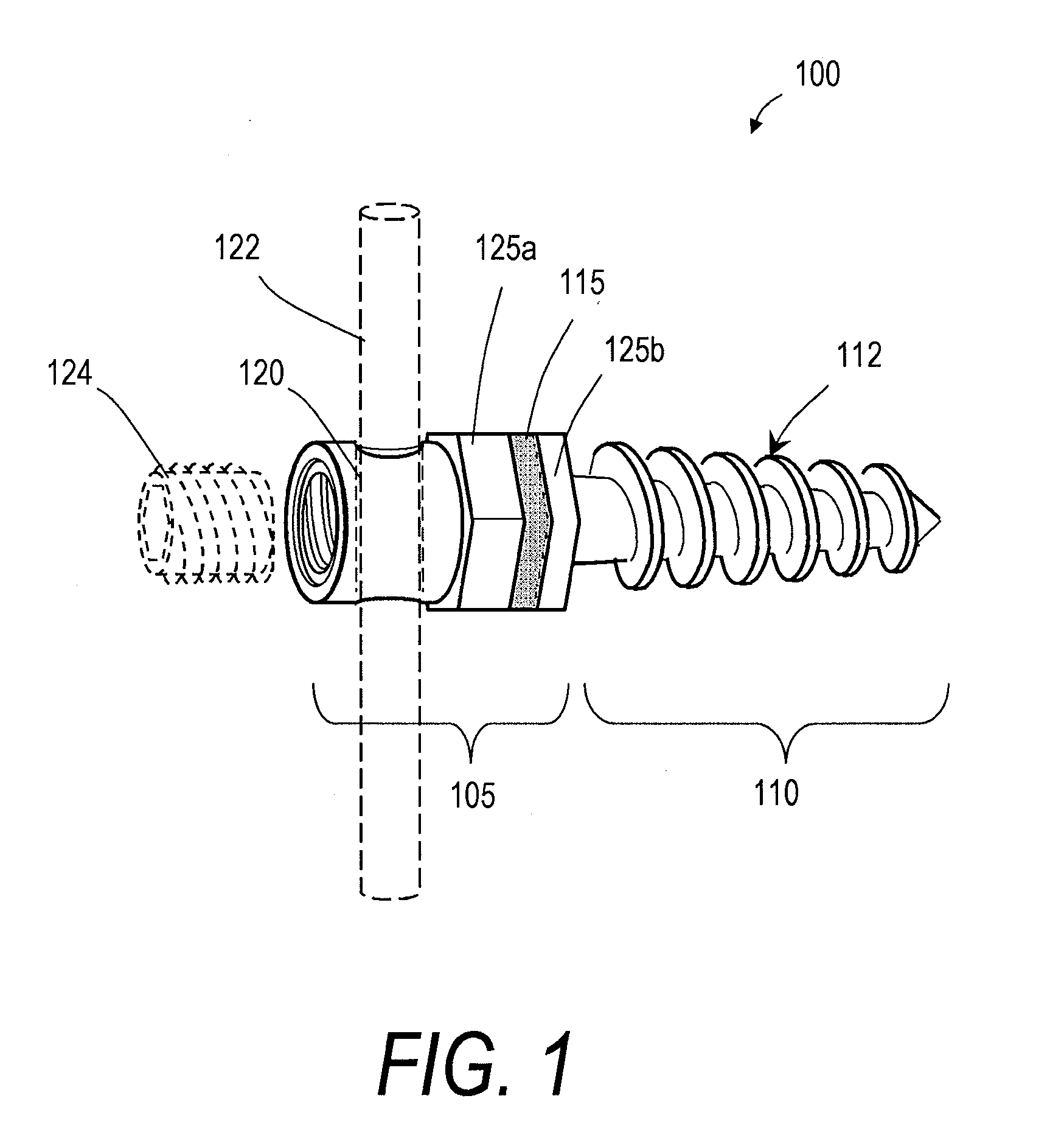 Spine treatment devices and methods