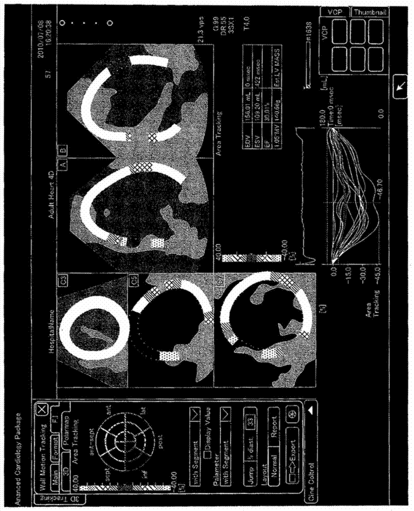 X-ray diagnostic device and arm control method