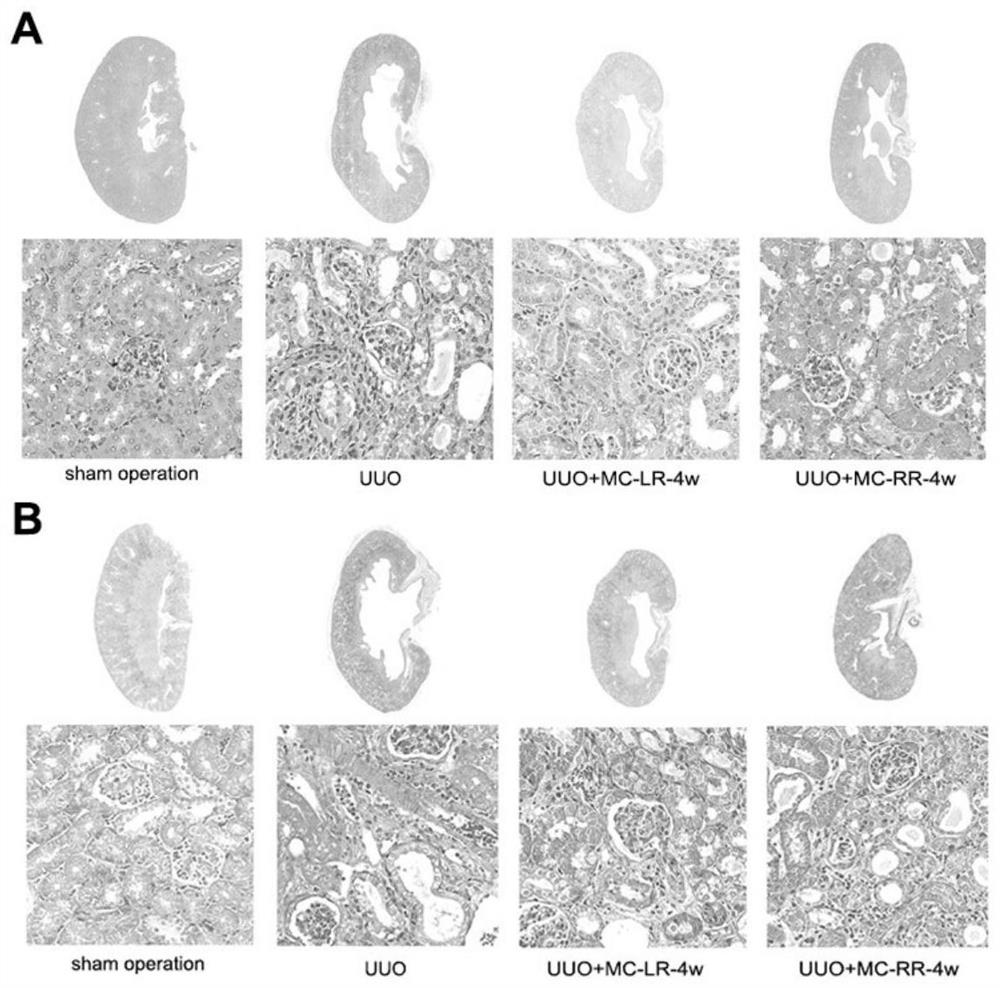 Use of microcystin-RR in preparing drugs for preventing or treating renal fibrosis diseases