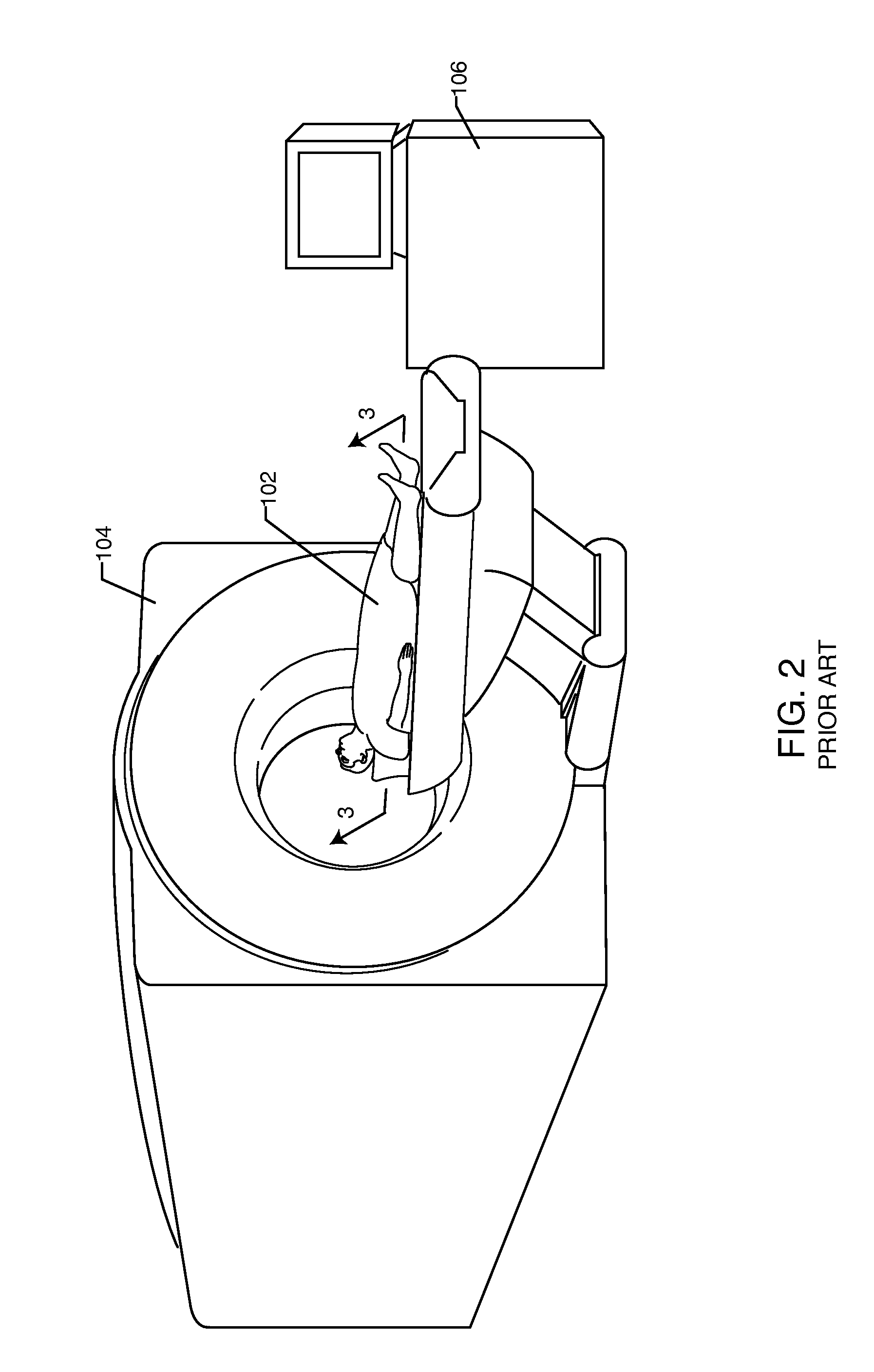 RF filter for an active medical device (AMD) for handling high RF power induced in an associated implanted lead from an external RF field
