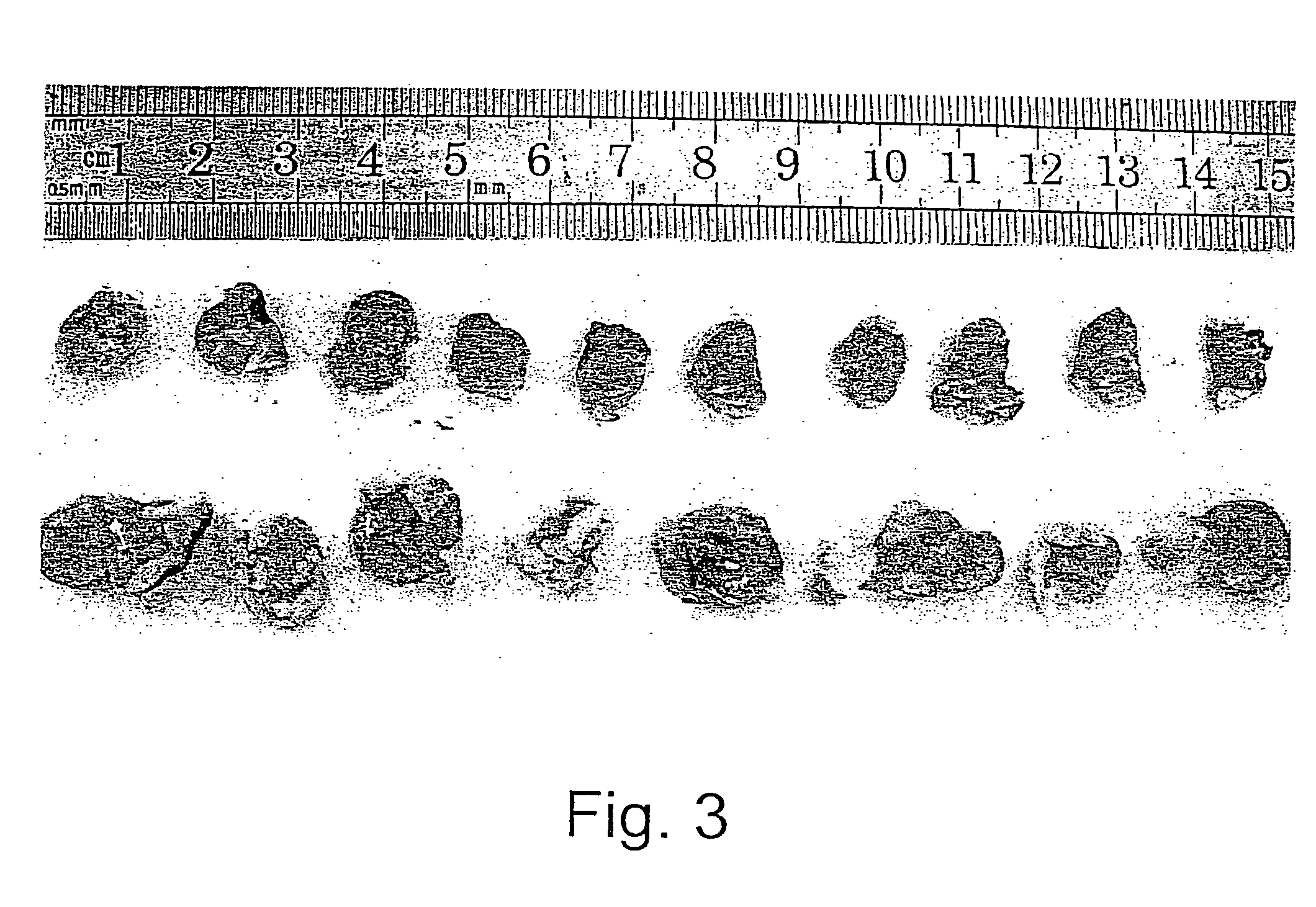 Methods and uses of leptin in immune modulation and hepatocellular carcinoma