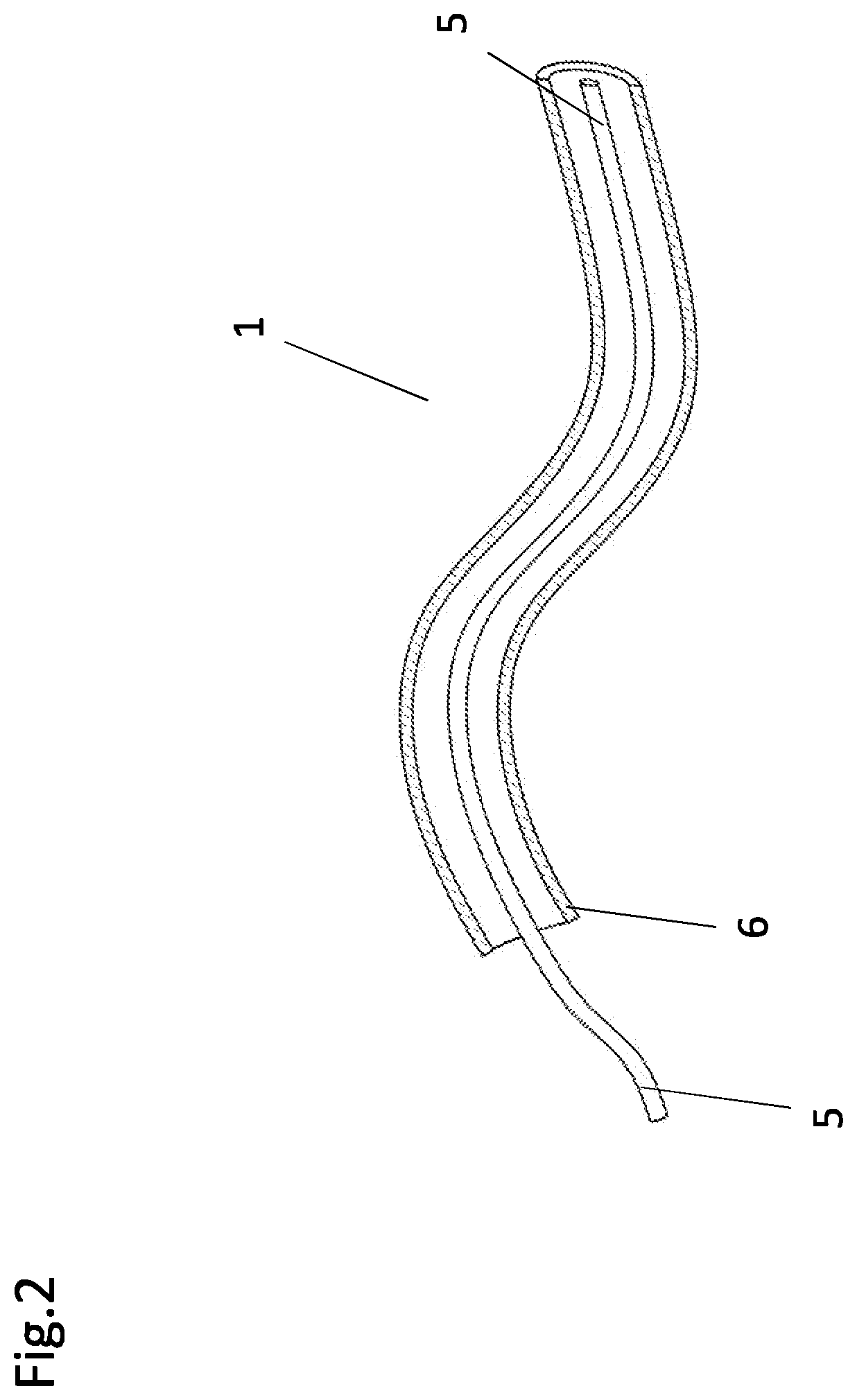 System, method and catheter for pituitary and brain implantation