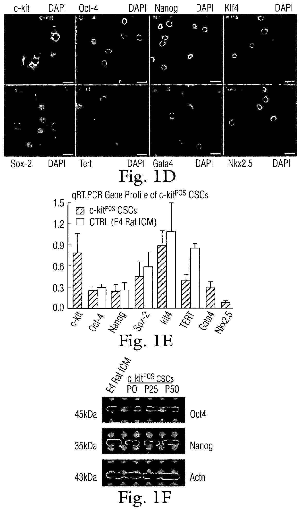 Modulation of cardiac stem-progenitor cell differentiation, assays and uses thereof
