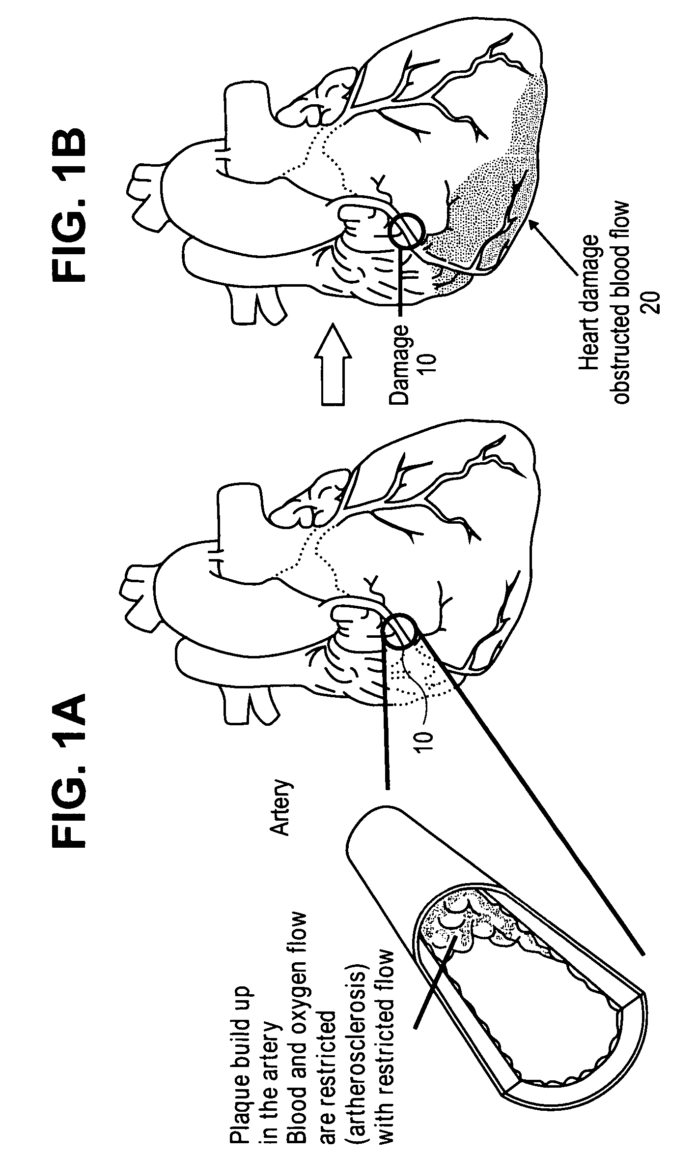 Modified two-component gelation systems, methods of use and methods of manufacture
