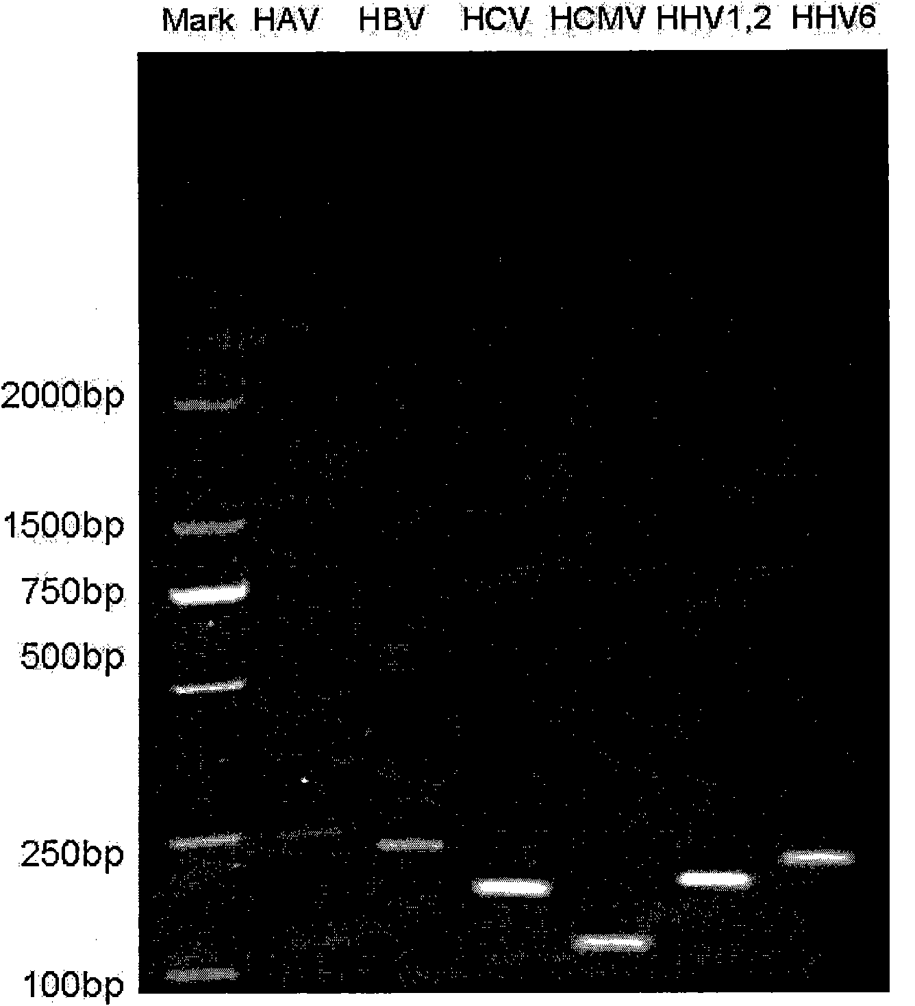 Multiple PCR detection kit for virus hepatitis pathogens and preparation and application thereof