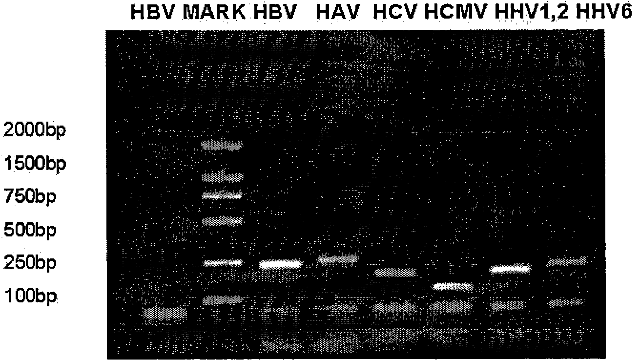 Multiple PCR detection kit for virus hepatitis pathogens and preparation and application thereof