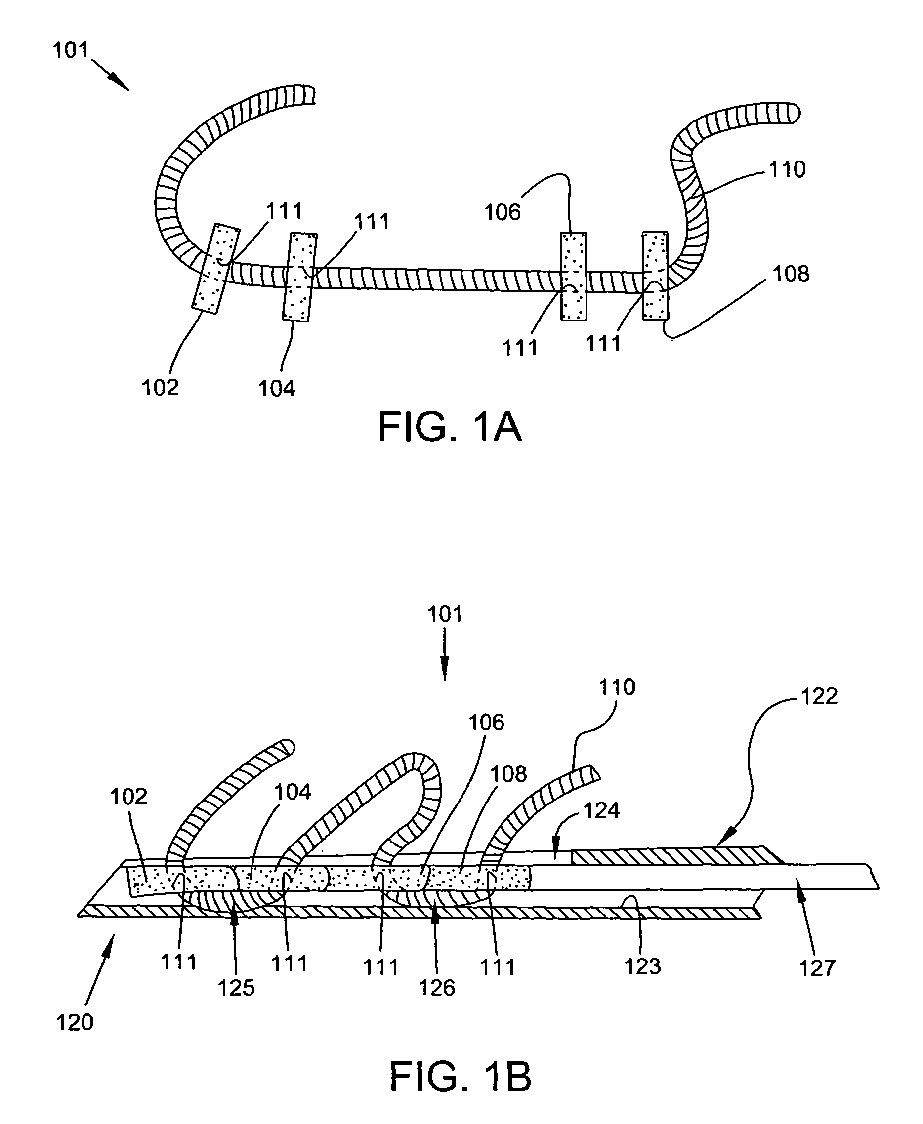 Method and apparatus for closing fissures in the annulus fibrosus