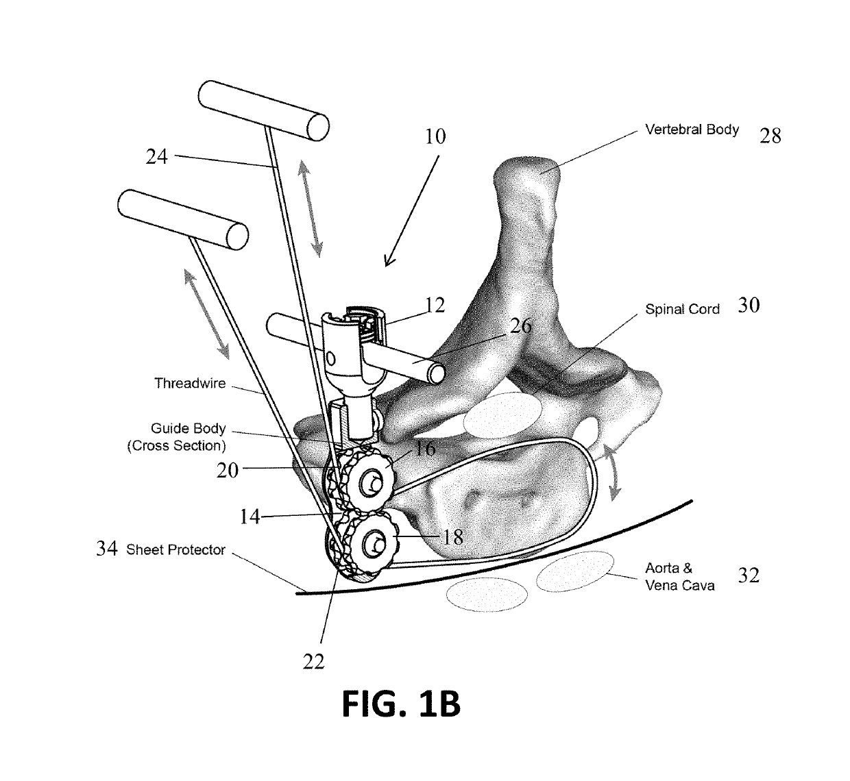 Vetebral osteotomy saw guide