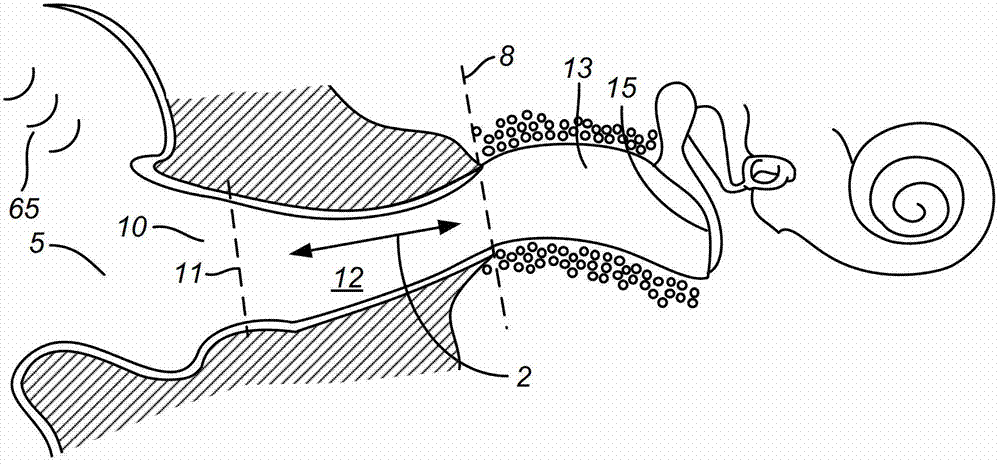 Perpendicular docking into canal hearing device, and battery module
