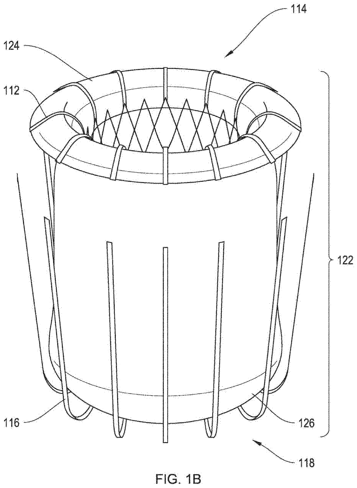 Transcatheter mitral valve