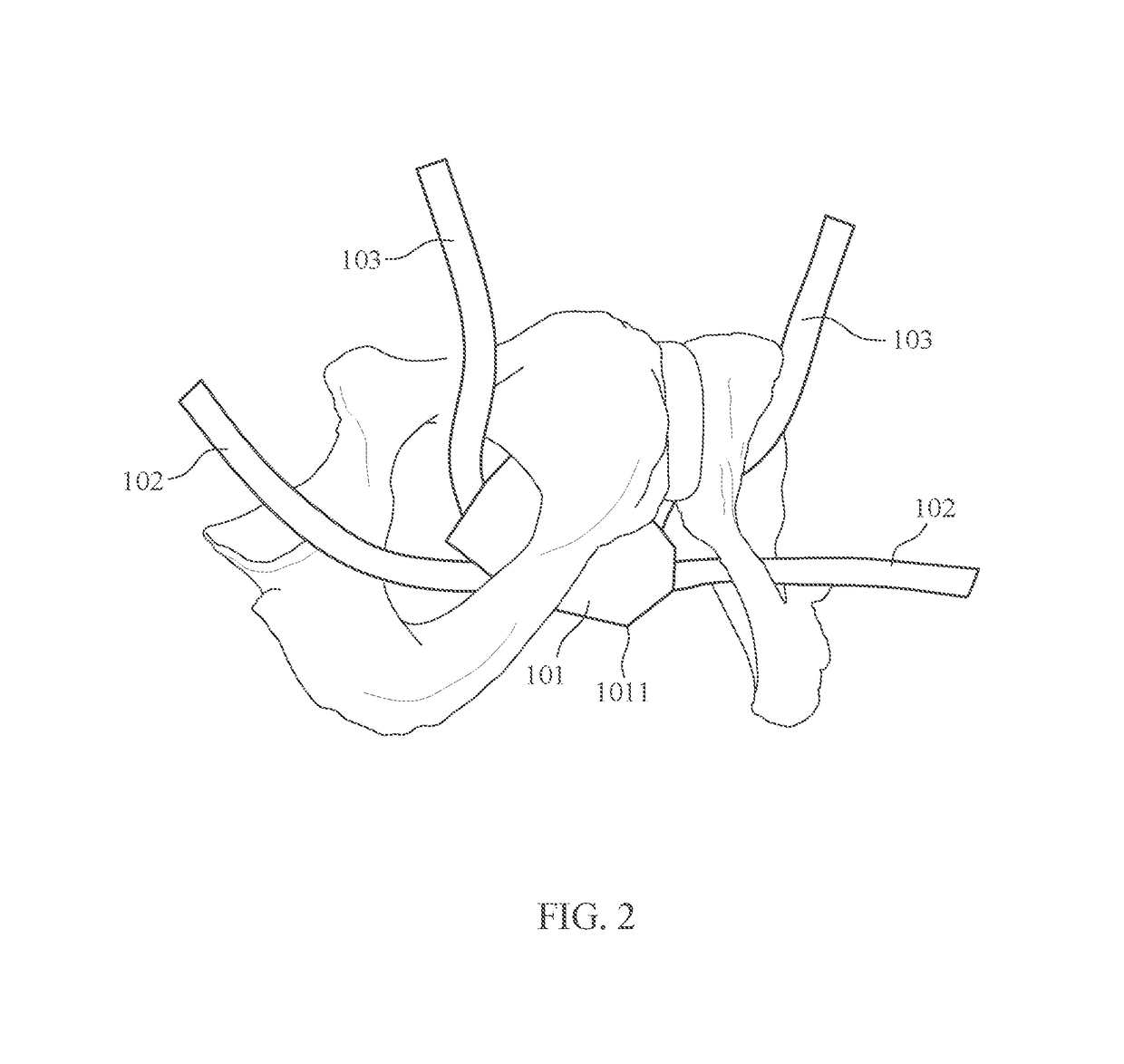 Implants for pelvic organ prolapse support