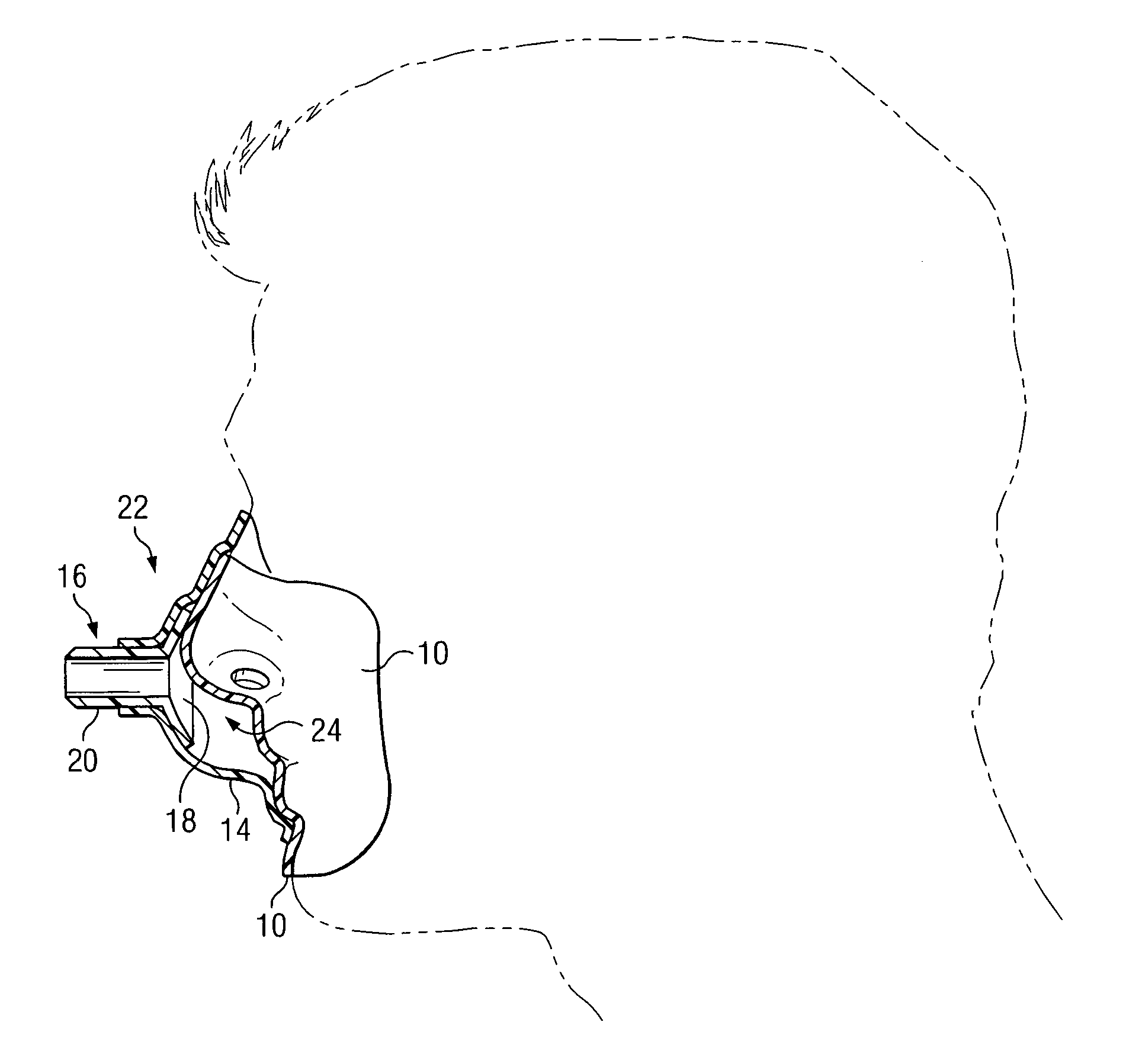 Custom fitted mask configured for coupling to an external gas supply system and method of forming same