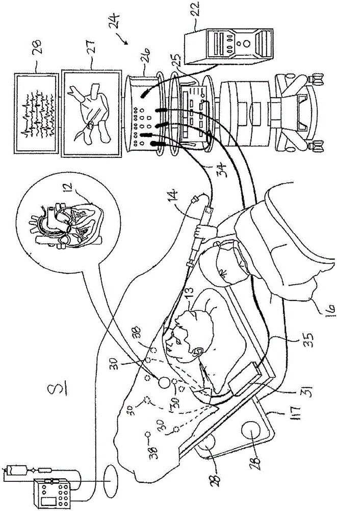 System and method for controlling catheter power based on contact force