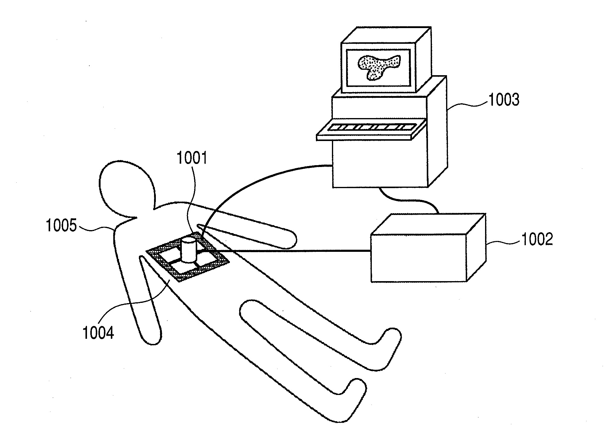 Ultrasonic diagnostic imaging system and control method thereof