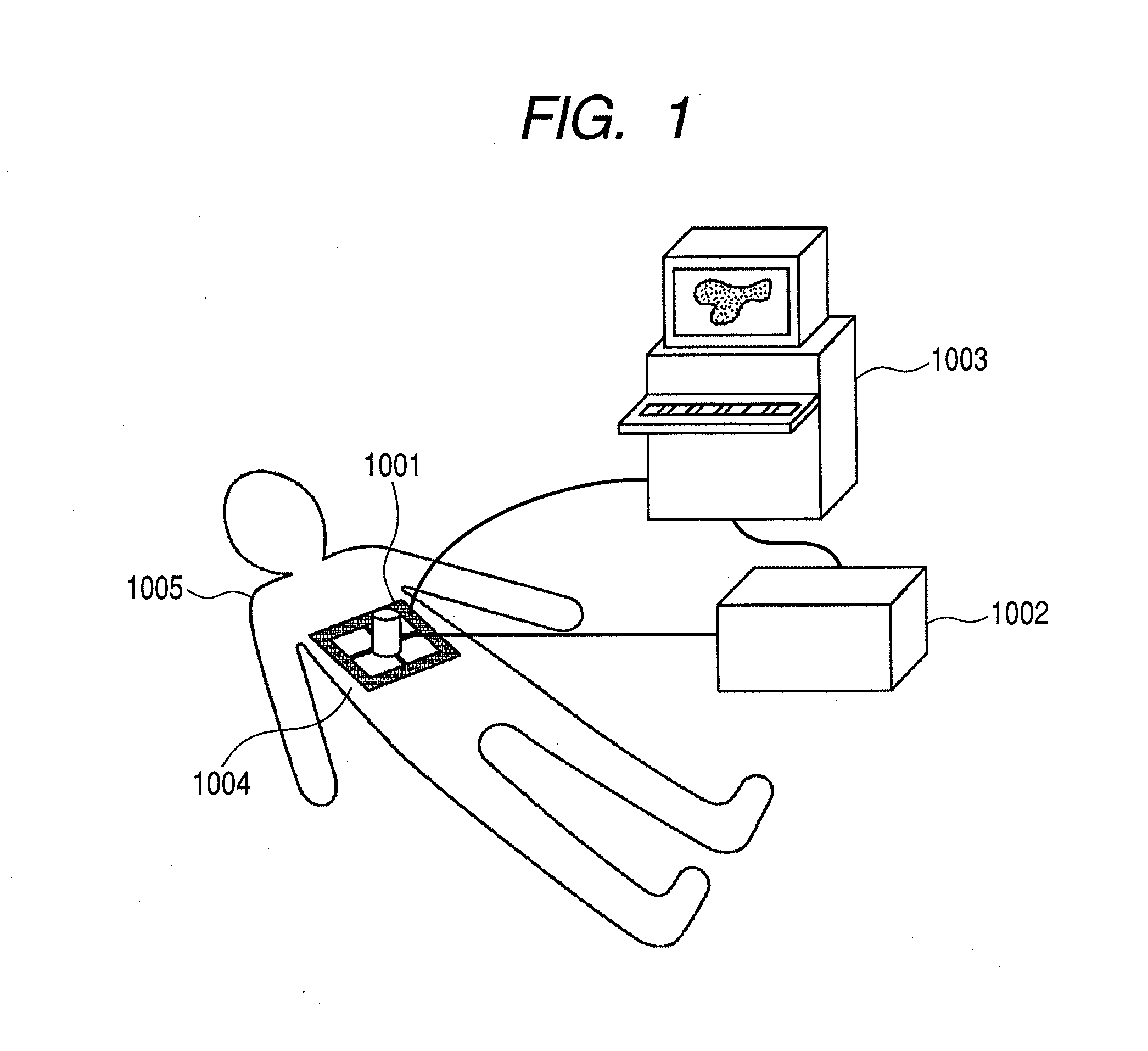 Ultrasonic diagnostic imaging system and control method thereof