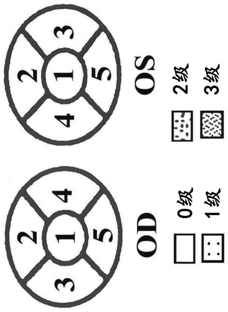 Combinations of positive allosteric modulators and nicotinic acetylcholine receptor agonists for treating ocular conditions