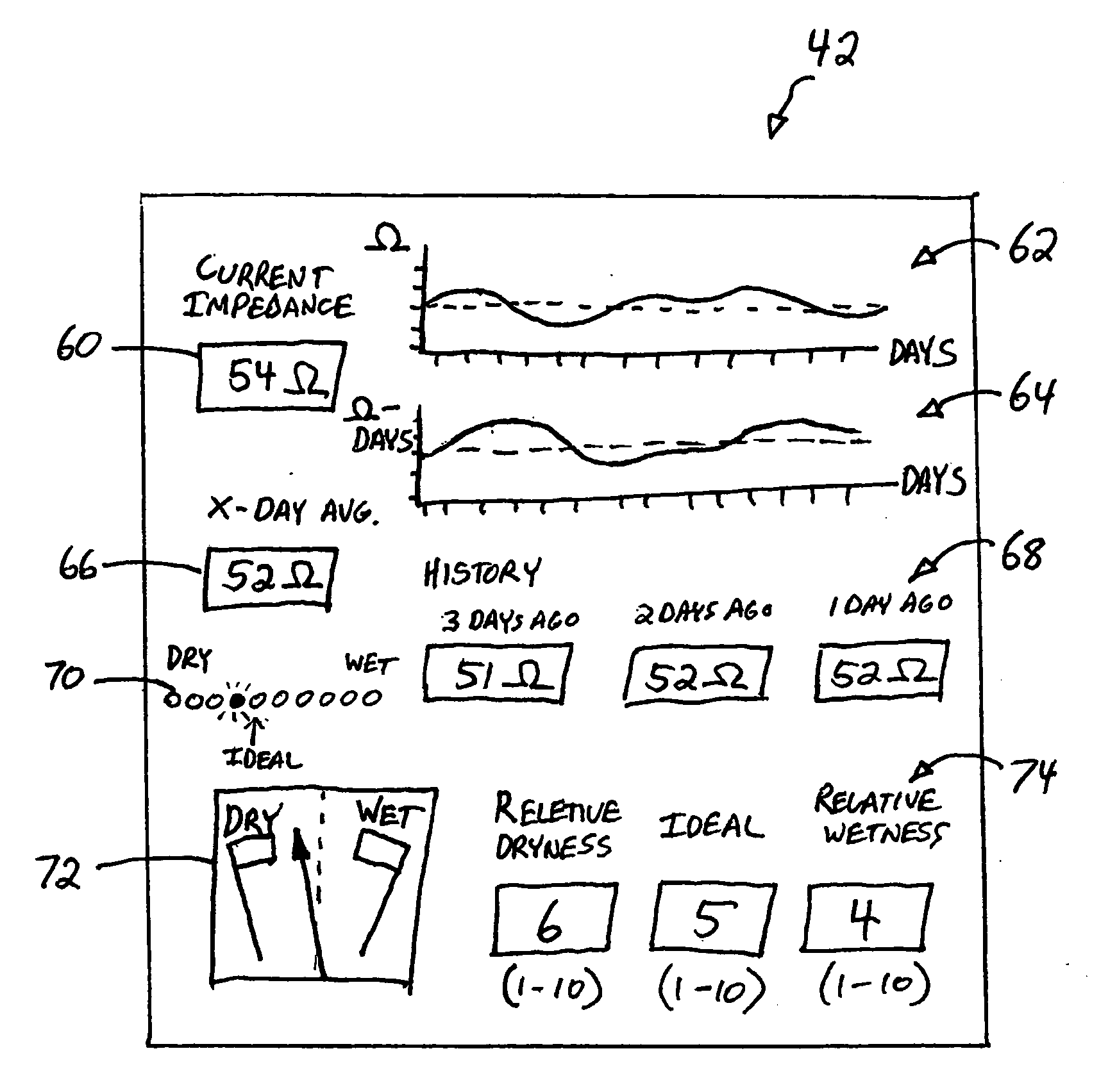 Edema monitoring system and method utilizing an implantable medical device