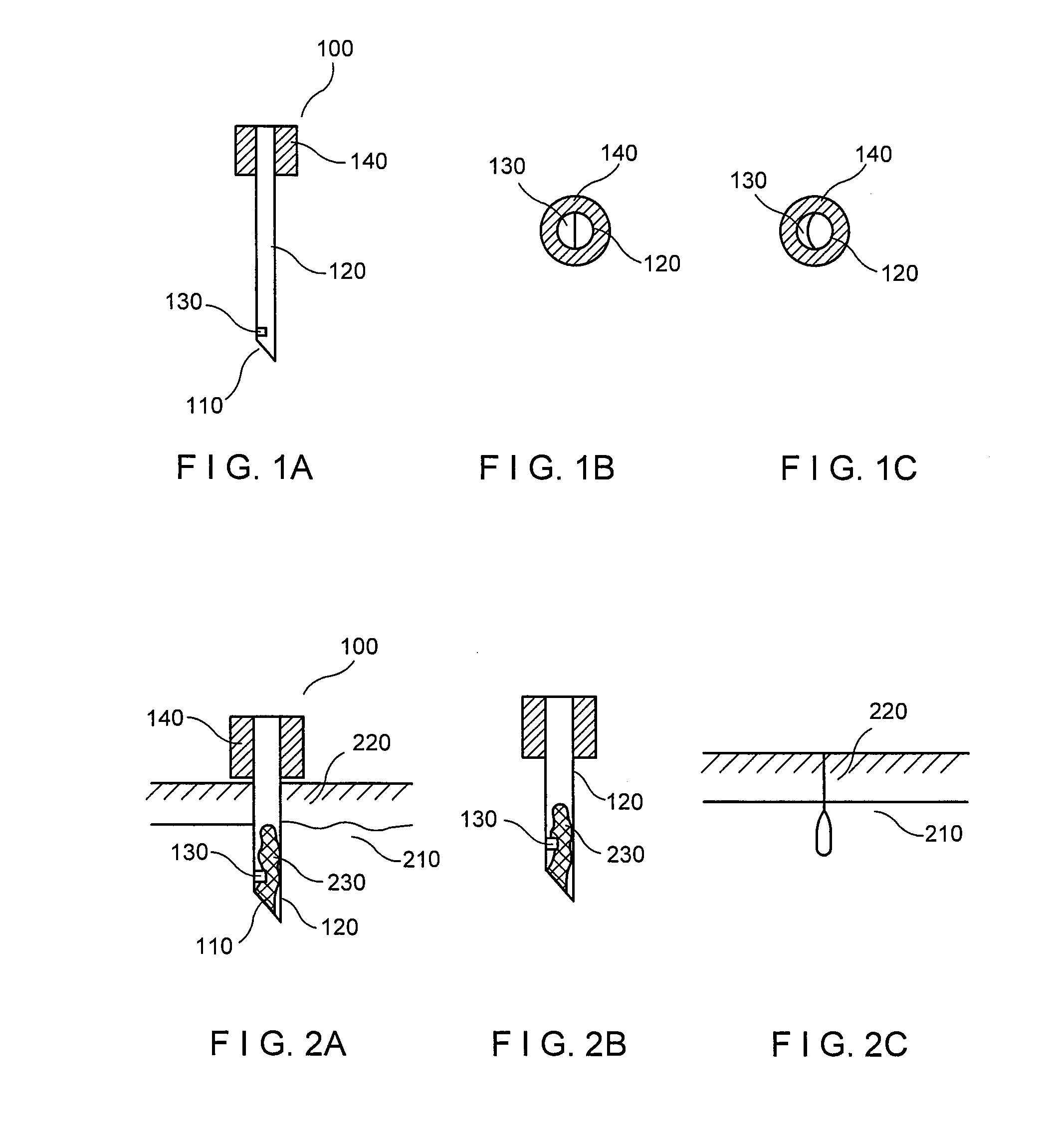 Method and apparatus for damage and removal of fat