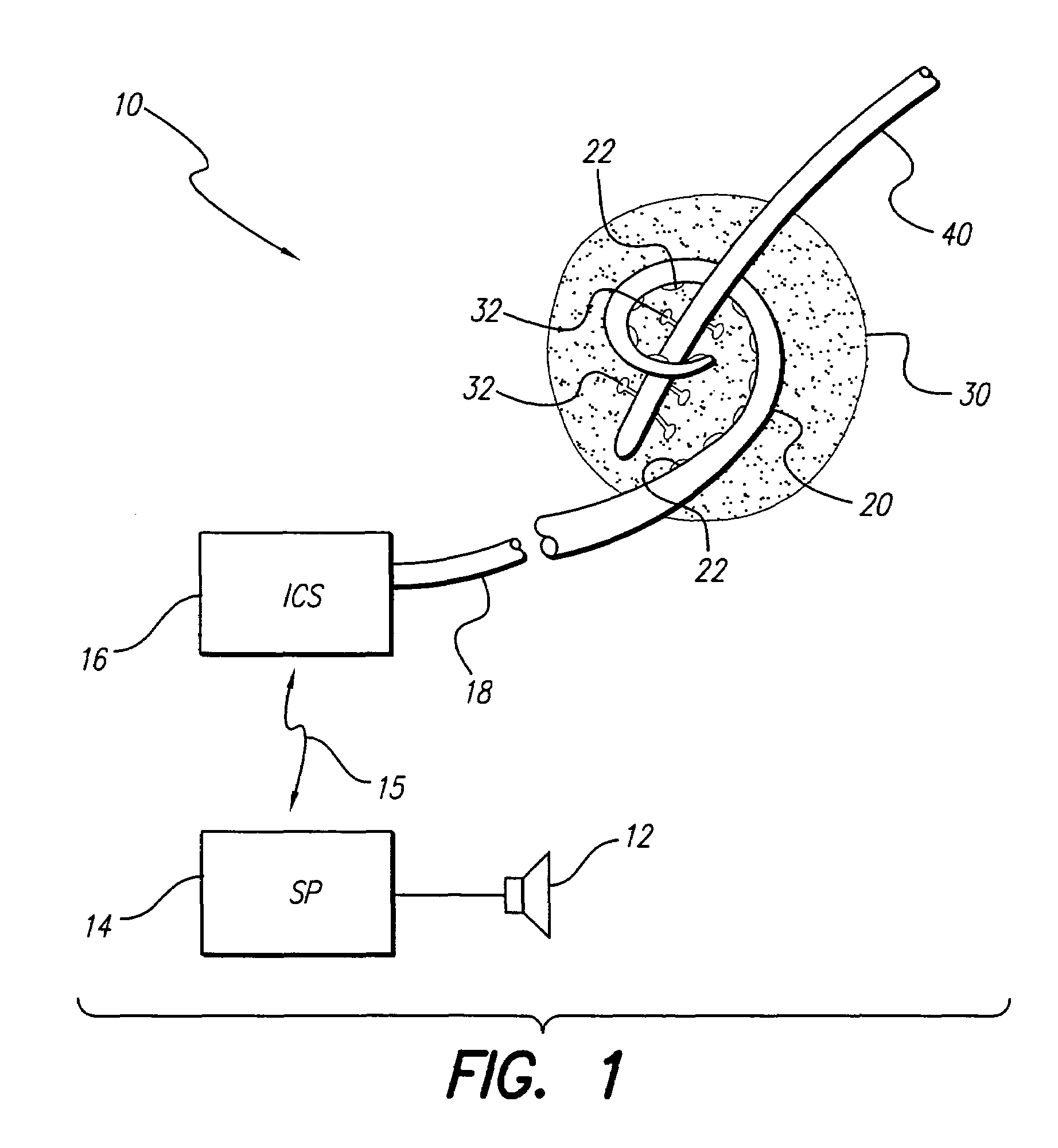 System and method for using a multi-contact electrode to stimulate the cochlear nerve or other body tissue