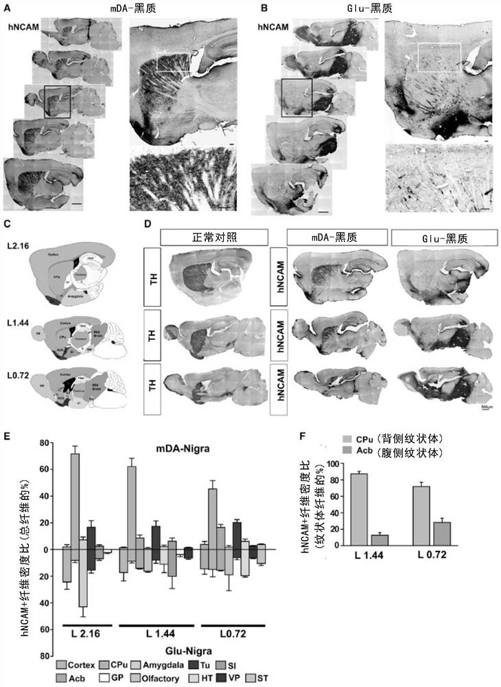 Method for differentiating pluripotent stem cells into midbrain black matter dopaminergic nerve cells