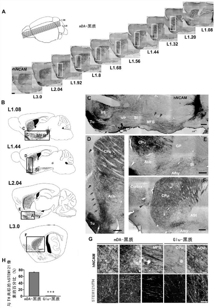 Method for differentiating pluripotent stem cells into midbrain black matter dopaminergic nerve cells