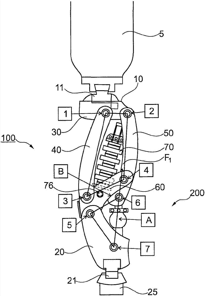 Prosthetic Knee