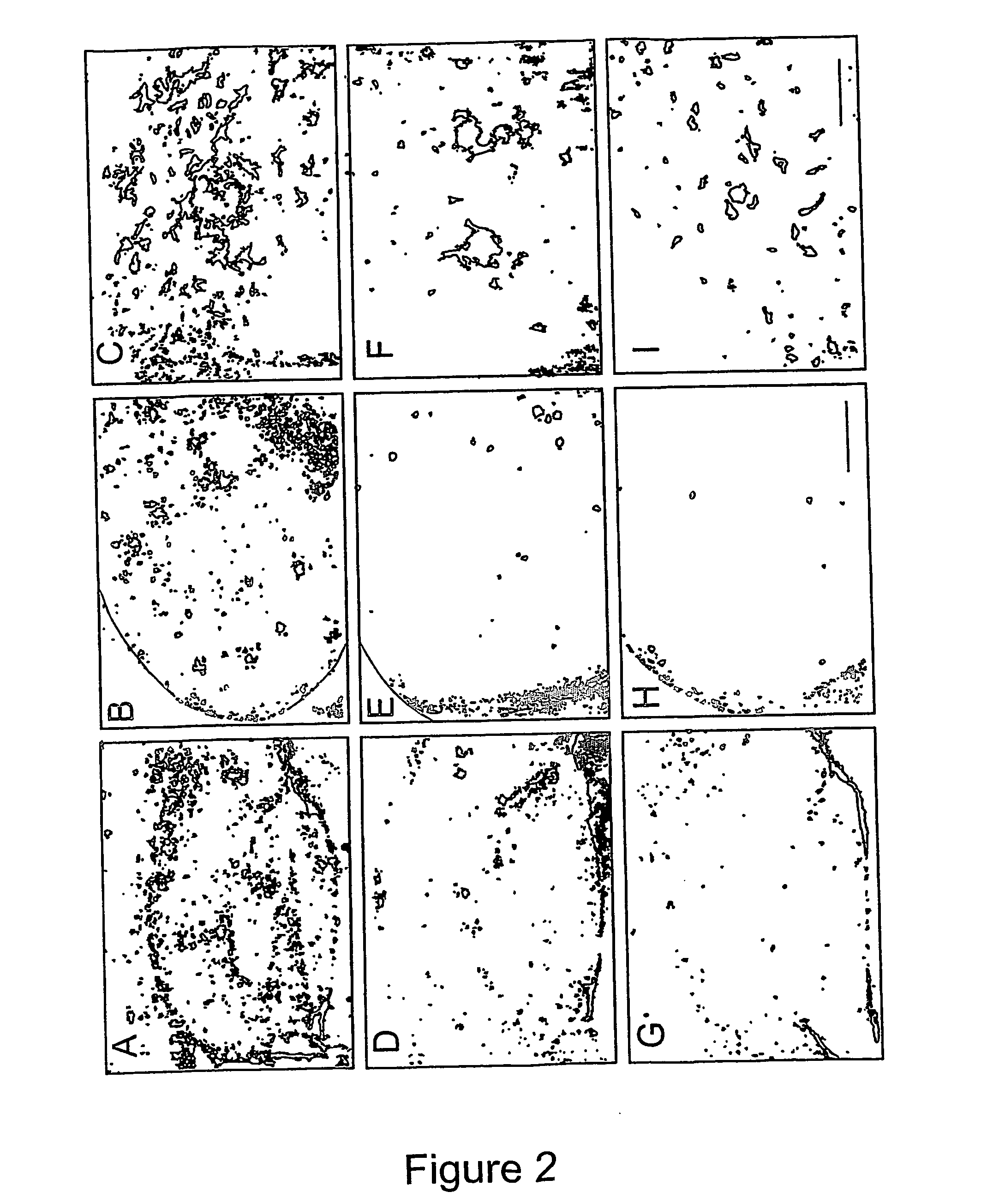 Method of preventing, treating and diagnosing disorders of protein aggregation
