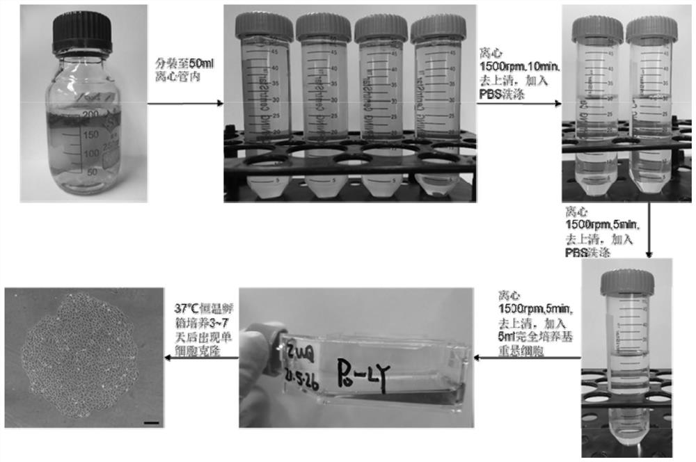 Biological agent for treating arthritis as well as preparation method and application of biological agent