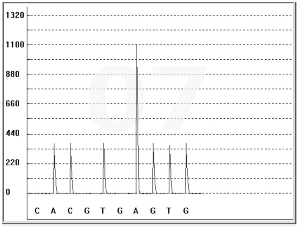 Nitroglycerin metabolism marker detection kit and detection method and application thereof