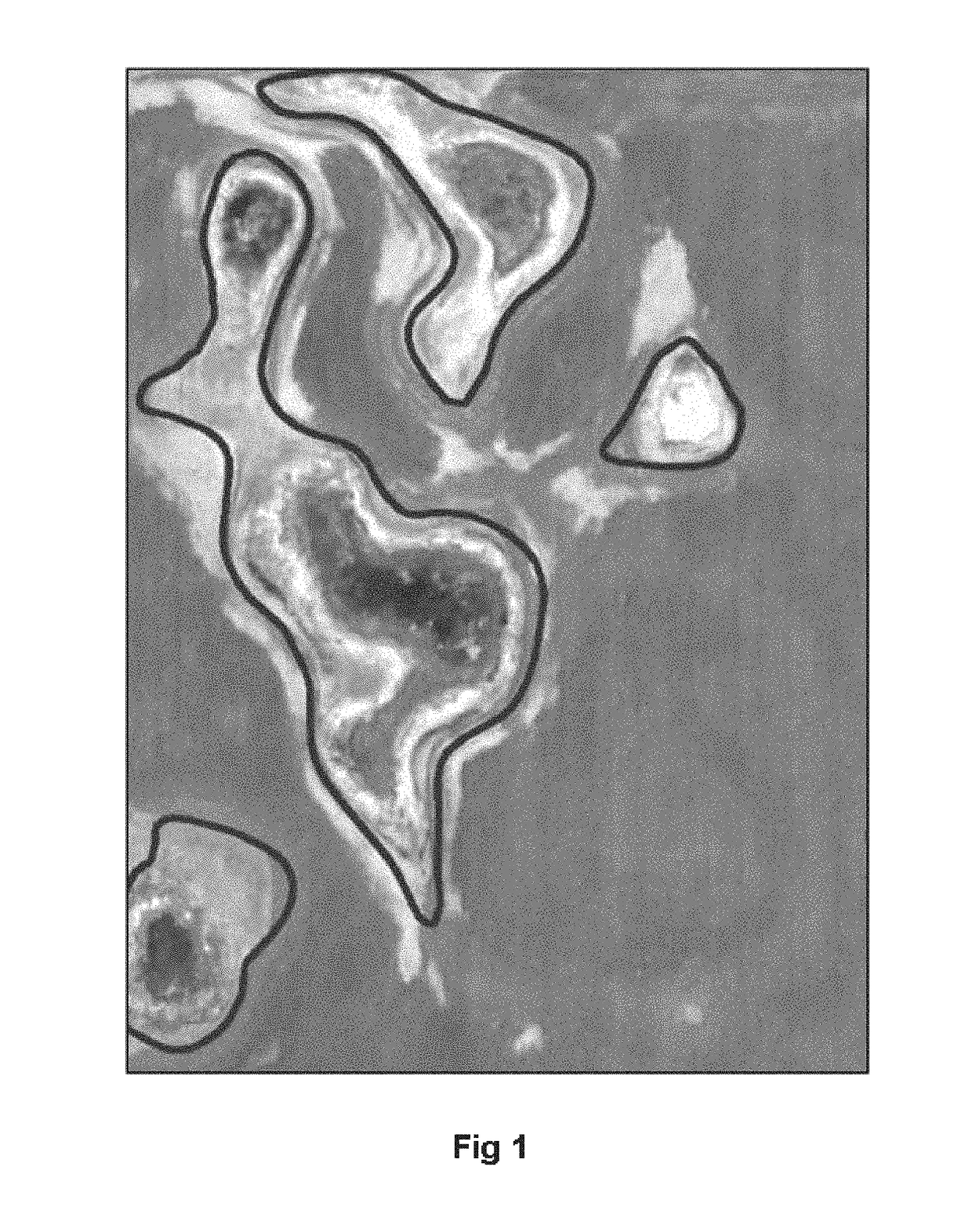 Method for automated crop insurance loss adjusting for prevented planting conditions