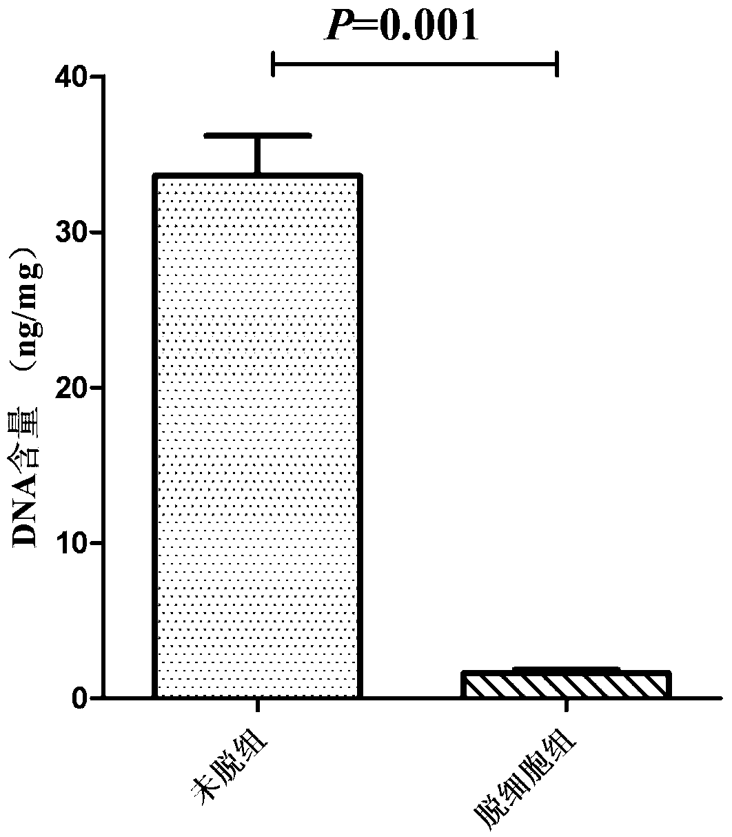 Bone accellular stent-based human multiple myeloma micro-environment model building method