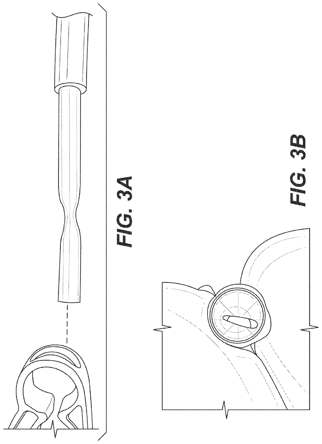 Plastic tubing kink removal device and method