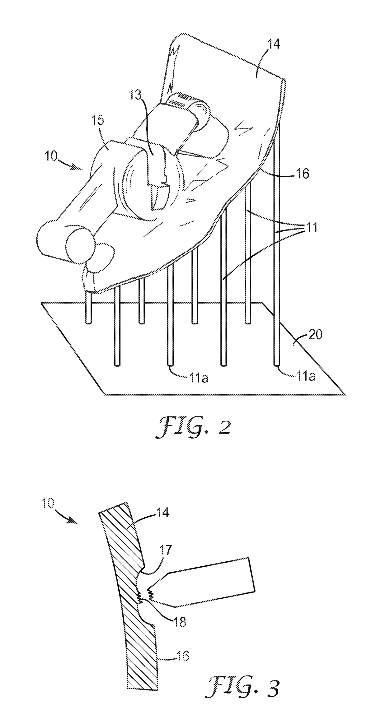 Method of making customized orthodontic brackets