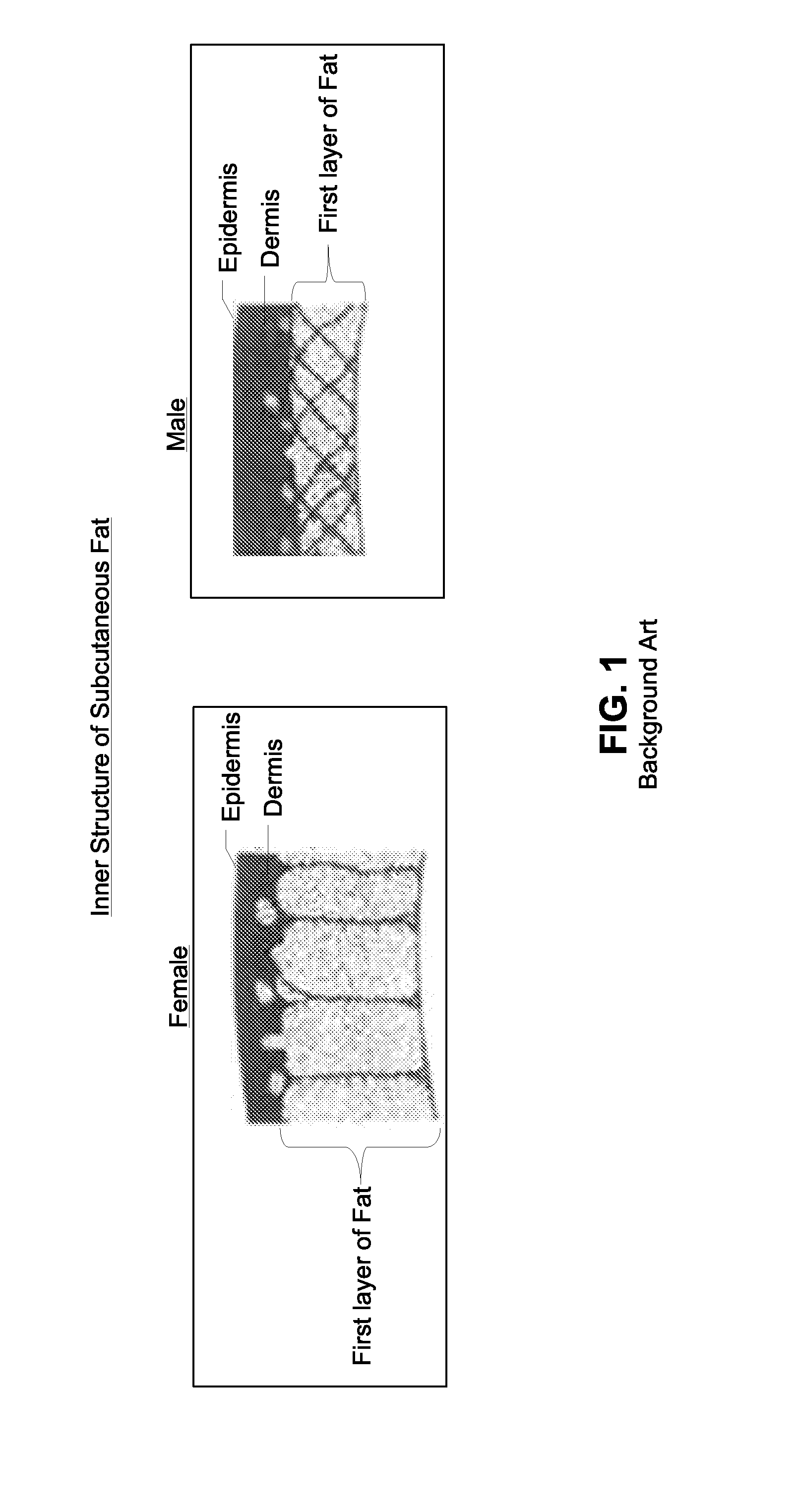 Cellulite and fat reducing device and method utilizing optical emitters