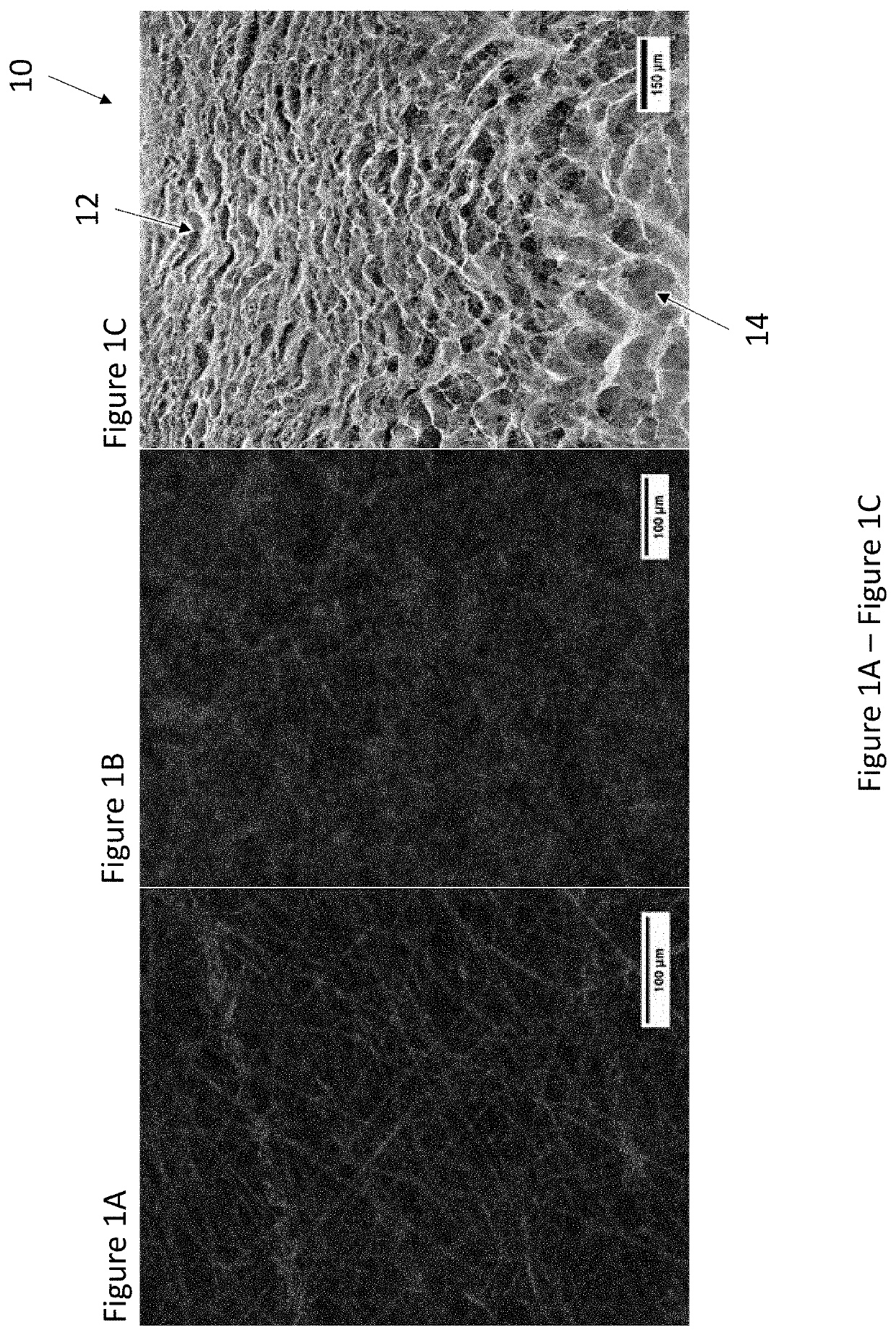 Graded Porous Scaffolds as Immunomodulatory Wound Patches