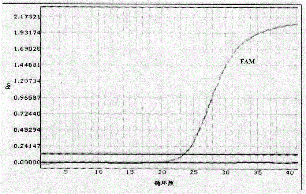 Kit for detecting human ABCC4 gene polymorphism and application thereof