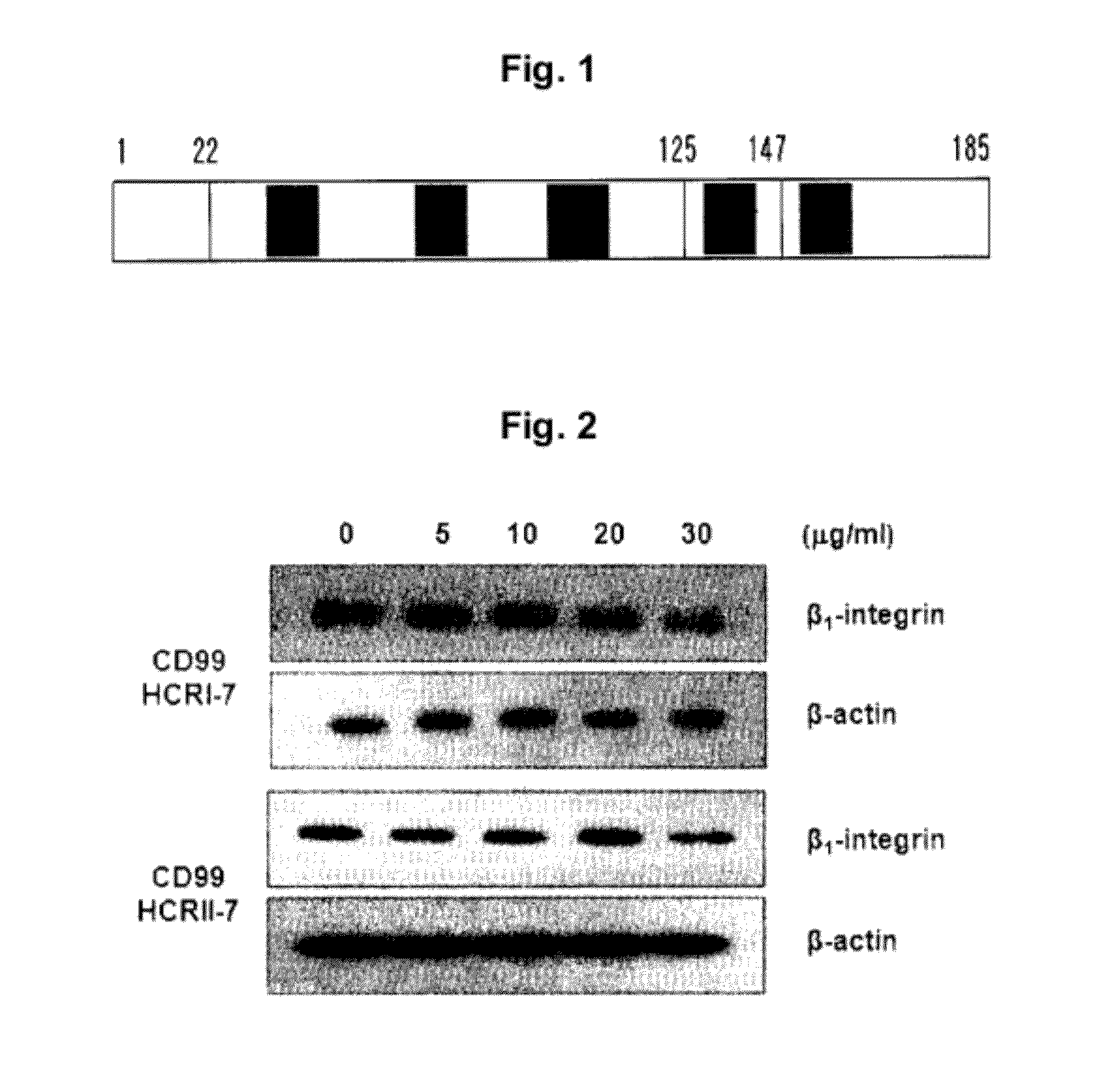 Isolated polypeptides used for treatment of inflammatory diseases and inhibiting cancer metastasis