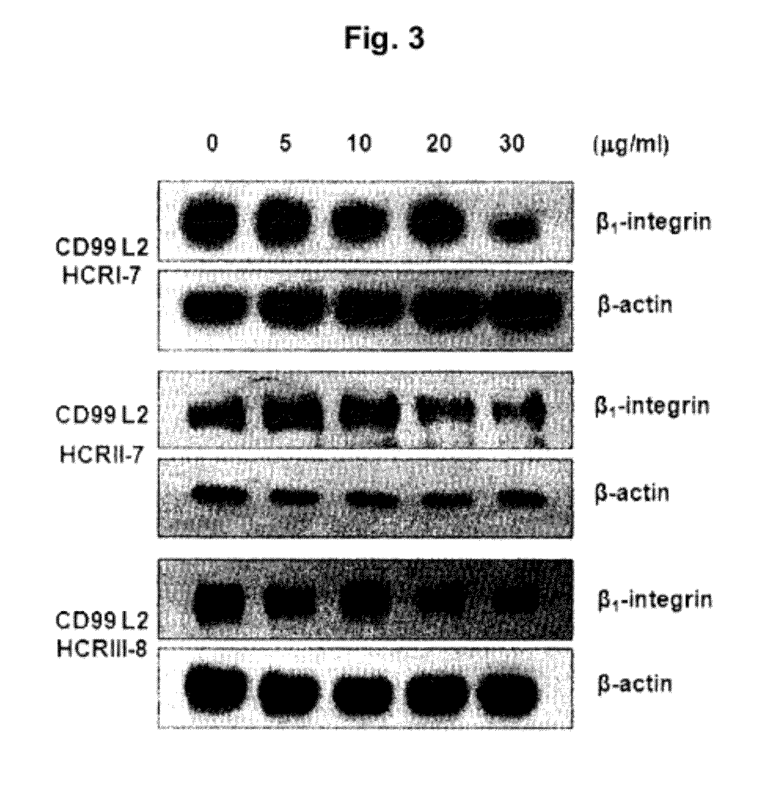 Isolated polypeptides used for treatment of inflammatory diseases and inhibiting cancer metastasis